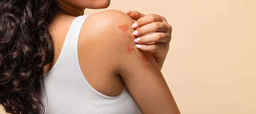 Cilt enfeksiyonları mikrop kaynaklı deri hastalıklarıdır.