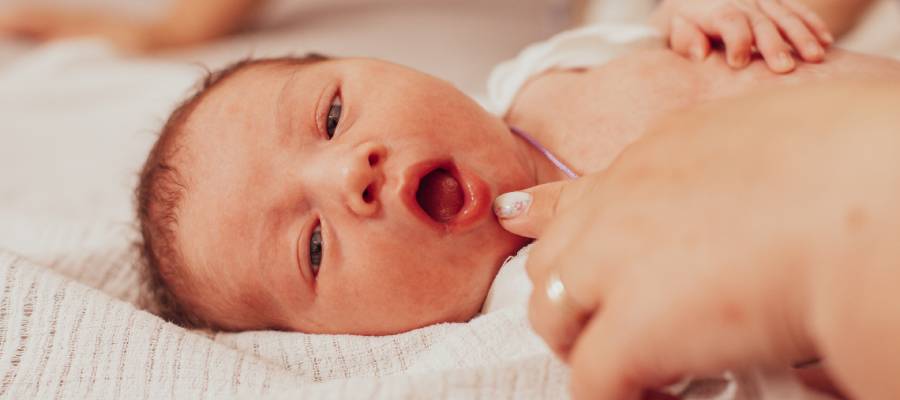 Bir sağlık uzmanı tarafından ağzı açık tutulan yeni doğmuş bir bebek, dil bağı (ankyloglossia) muayenesi sırasında.
