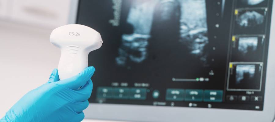 Ultrasonografi, testislerin görüntülenmesinde kullanılan bir yöntemdir.