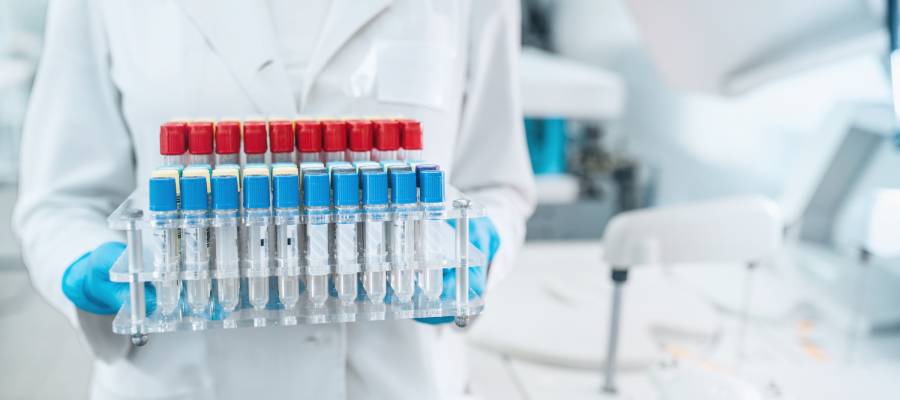 Tanı sürecinde laboratuar testleri önemli bulguları saptamayı sağlar.