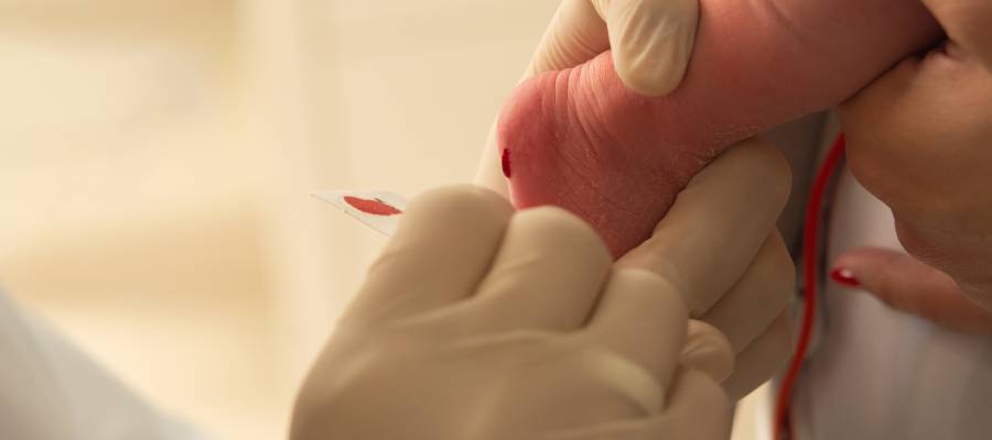 Yenidoğan tarama testleri galaktozemi tanısında oldukça önemlidir.