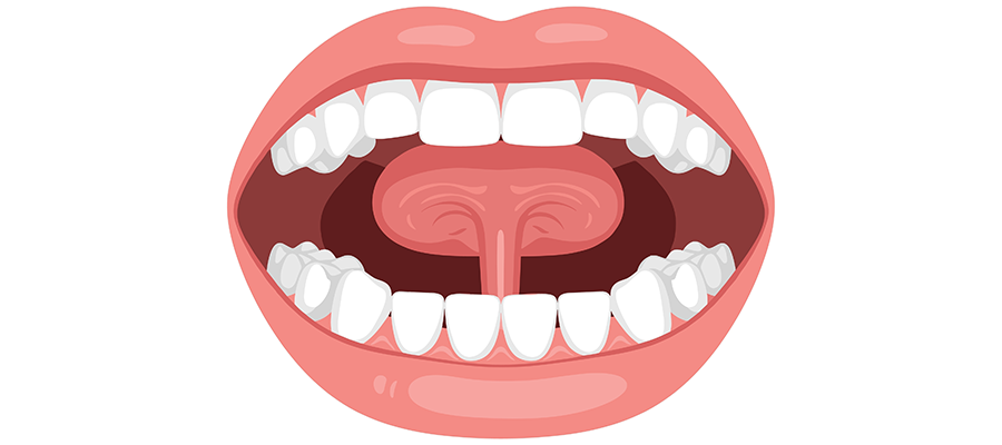 Açık bir ağızın içini, dişleri, dili ve damak yapısını gösteren çizim illüstrasyonu.