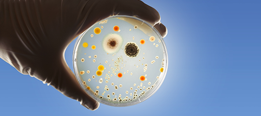 MRSA, antibiyotik direncine sahiptir ve temas yoluyla bulaşır.