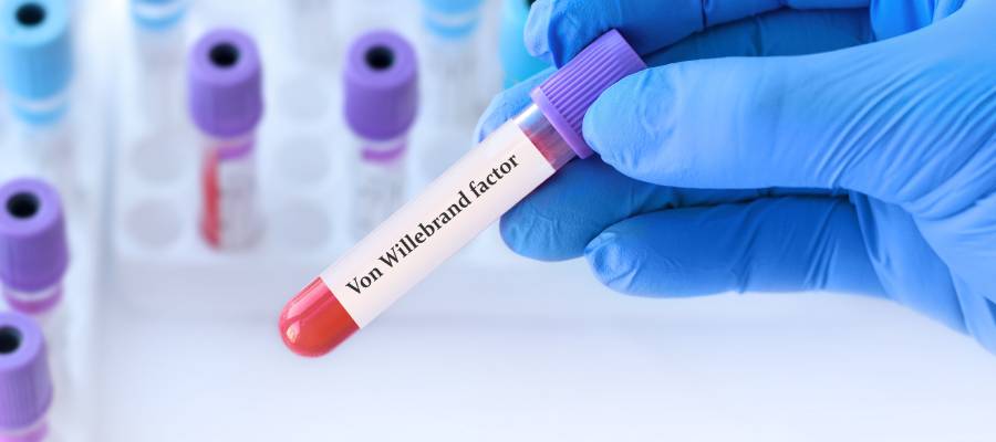 Von Willebrand Hastalığı (VWD), kanın pıhtılaşmasını engelleyen kalıtsal bir kanama bozukluğudur.