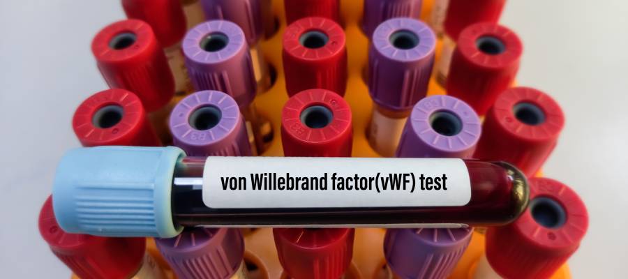 Doğru tanı için kan testleriyle hastalığın tipi belirlenmeli buna uygun tedavi planlanmalıdır.