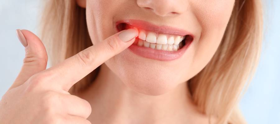 Diş eti kanamaları Von Willebrand hastalığı belirtileri arasında yer alır.