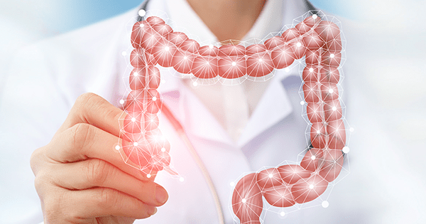 Treatment of Crohn’s Disease and Colitis