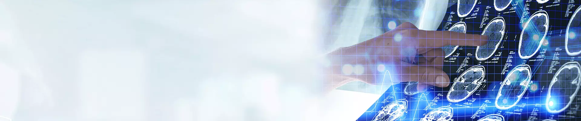 Girişimsel Nöroradyoloji