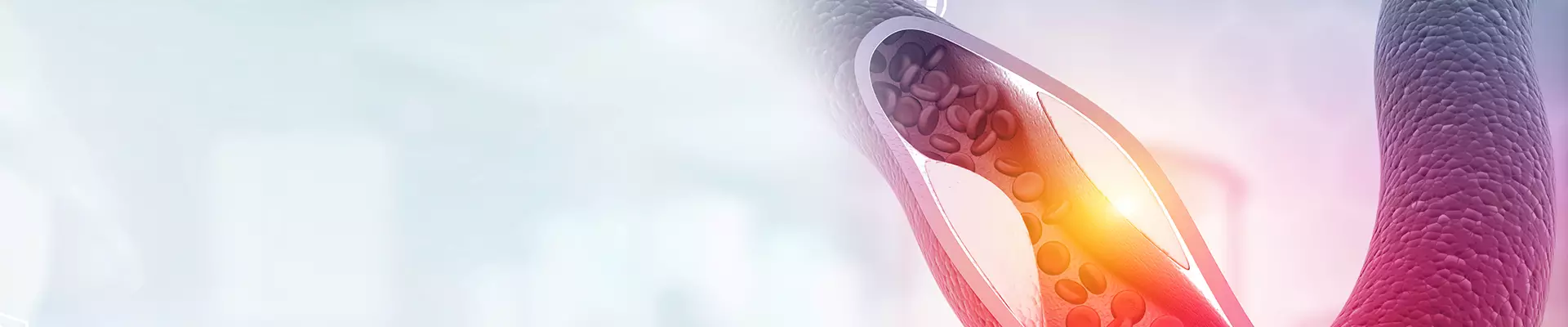 Kaçış Sendromu Nedir? Kaçış Senromu Belirtileri ve Tedavisi