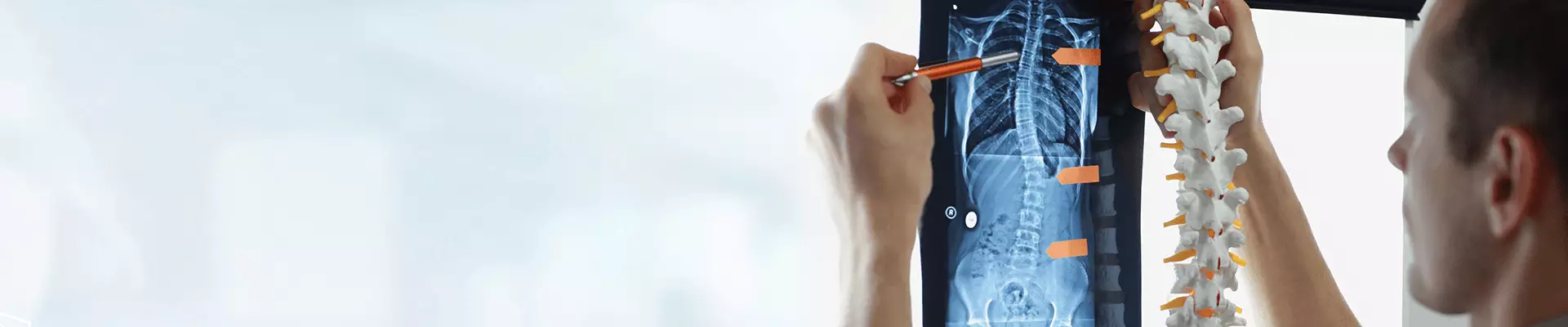 Skolyoz Nedir, Belirtileri Nelerdir? Omurga Eğriliği Nasıl Düzelir?