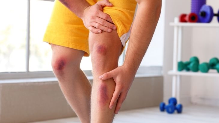 Miyelodisplastik sendrom kırmızı kan hücresi eksikliğine bağlı kolay morarma, halsizlik ve enfeksiyon riskinin artması gibi belirtilerle kendini gösterir.