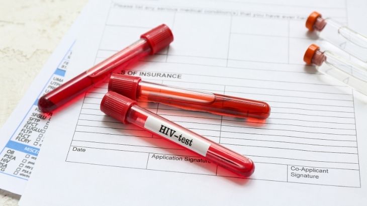 HIV testinin pozitif çıkması durumunda hemen tedaviye başlanması gerekir.