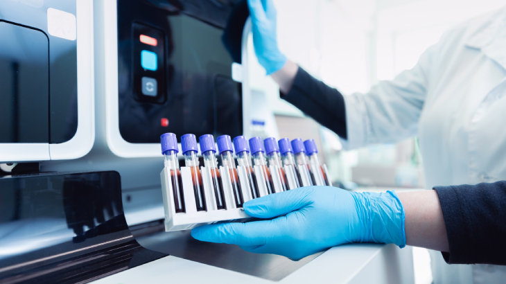 ACHT testi hormon kaynaklı hastalıkların teşhis edilmesine yardımcı olur ve doğru tedaviye yönlendirebilir.