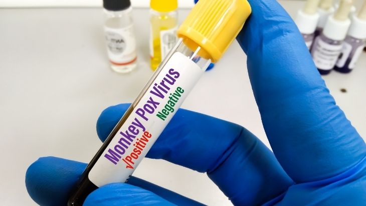 Maymun çiçeği virüsü teşhisi