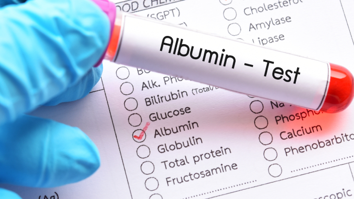 Albümin testi, kandaki albumin protein seviyesini ölçerek vücudun genel sağlık durumunu değerlendirmeye yarar.
