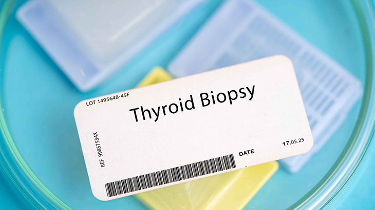 Tiroid Biyopsisi