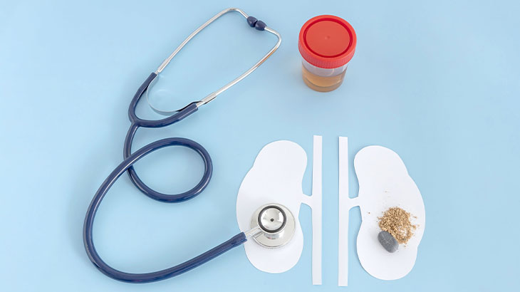 kadınlarda kum dökme belirtileri