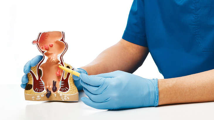 dış basura ne iyi gelir