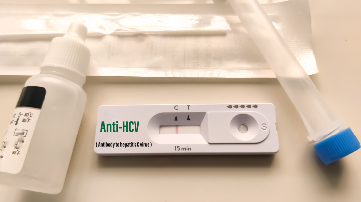 Koldan alınan kan ile Anti HCV testi hızlıca yapılır.
