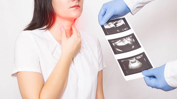 Tiroid Biyopsis nedir