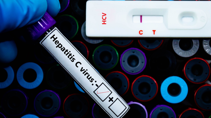Sonuçların yorumlanması ve gerektiğinde ek testlerin yapılması için doktorunuza danışmanız önemlidir.