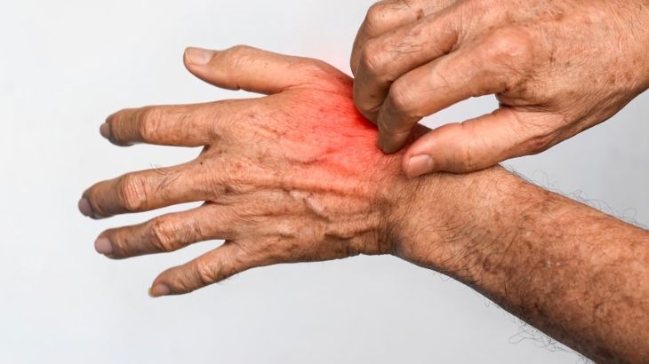 Hijyen eksikliği ve mantar enfeksiyonu temriyenin nedenleri arasında yer alır.