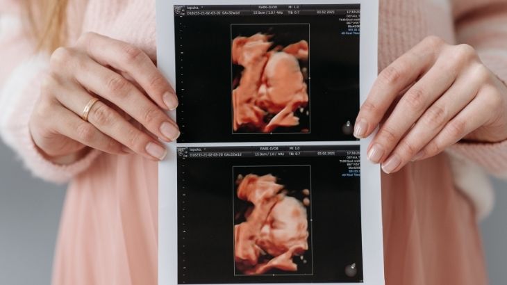 Psikolojik destek büyük öneme sahiptir.