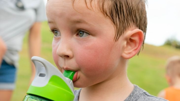 Bebek ve çocuklarda aşırı terleme tanısı ayrıntılı değerlendirmeyi gerektirir. 