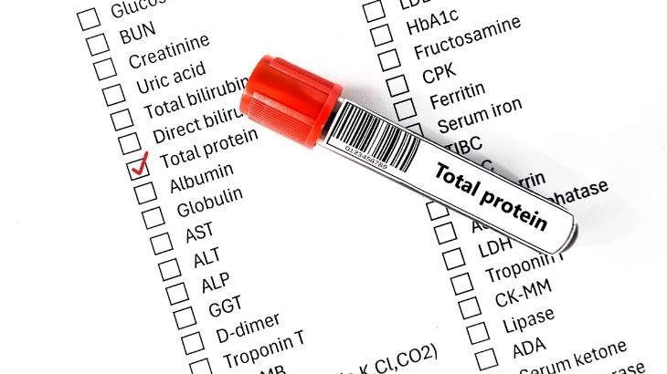 total protein nedir