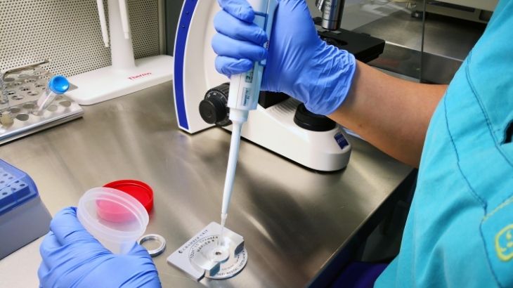 Tüp bebek tedavisi sperm azlığı yaşayan bireyler için umut olur.