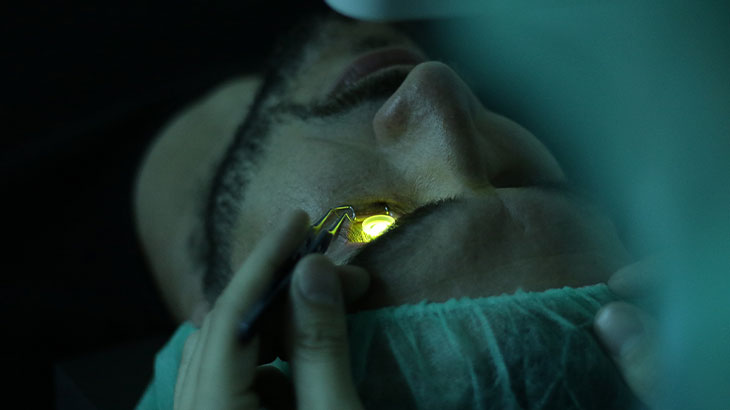 Korneal çapraz bağlama, kornea dokusunu güçlendirmek amacıyla uygulanan bir tedavi yöntemidir.