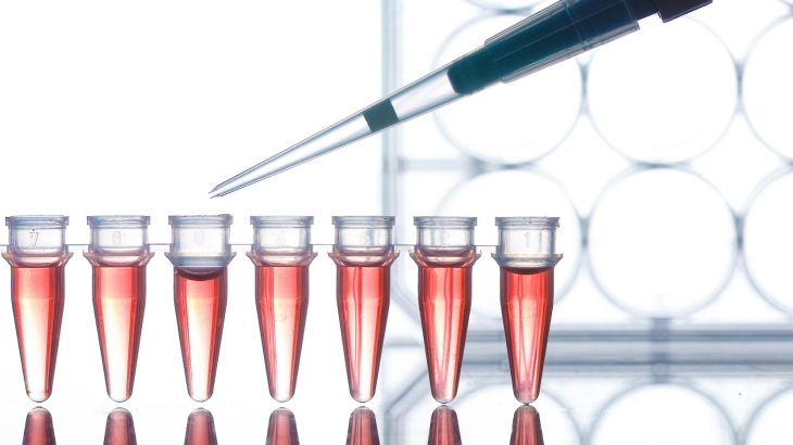 ELISA testi HIV tanısı için sıklıkla başvurulan bir yöntemdir.