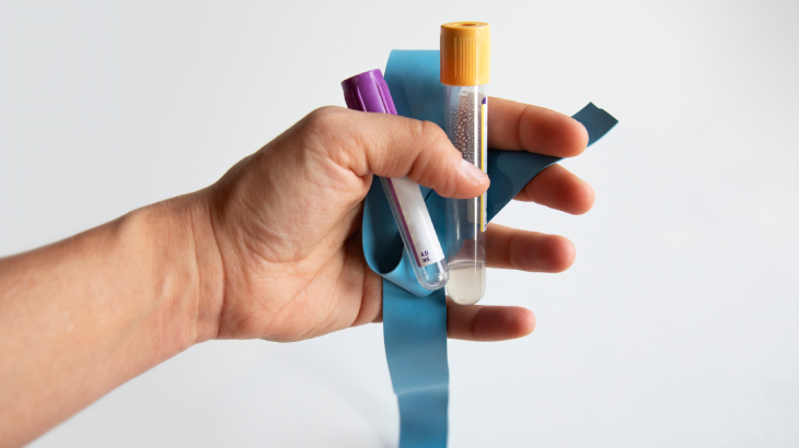 HLA B27 testi, bu özel genetik yapının kişide bulunup bulunmadığını belirlemek amacıyla yapılan kan analizidir.