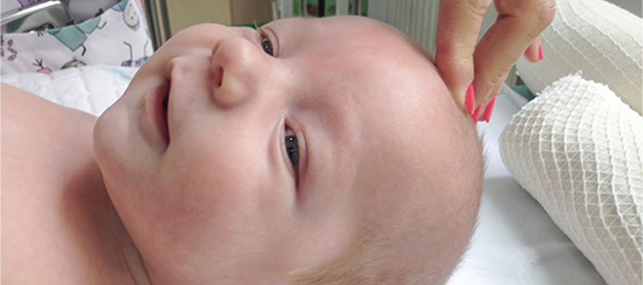 Bıngıldak genellikle 12 ila 18 ay arasında kendiliğinden kapanır, bu süreç bebeğin gelişim hızına göre değişiklik gösterebilir.