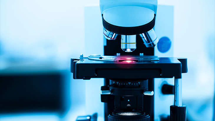 prostat biyopsisi nasıl yapılır