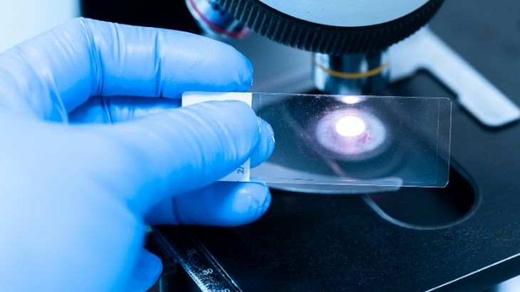 İnce iğne aspirasyon biyopsisi