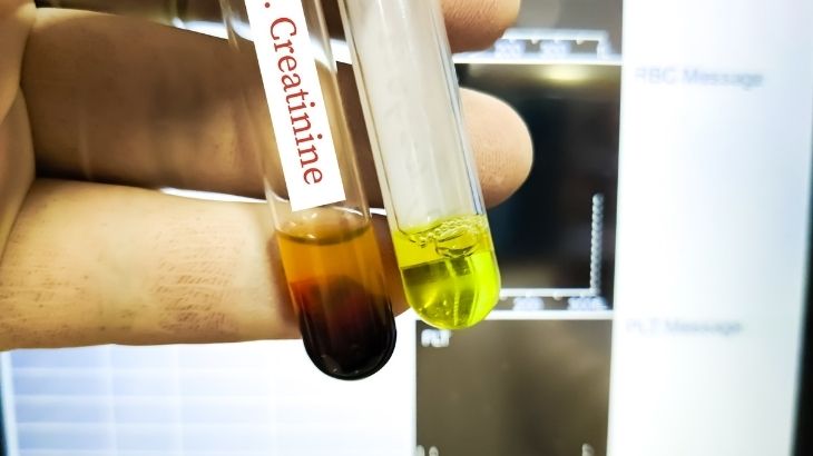 kreatinin düşüklüğü