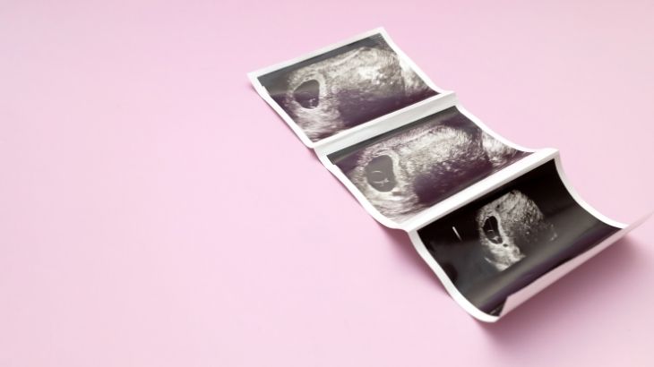 7 hafta gebelik belirtileri