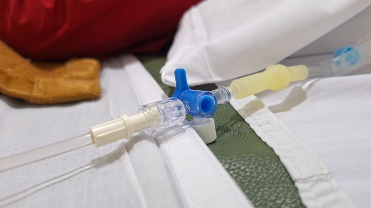 dren neden takılır