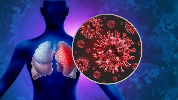  Tümörlü akciğer için lobektomi uygulaması