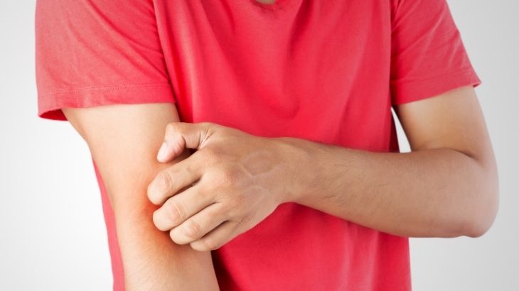 Temre (temriye) hastalığı, cilt yüzünde kaşıntı oluşmasına neden olur.