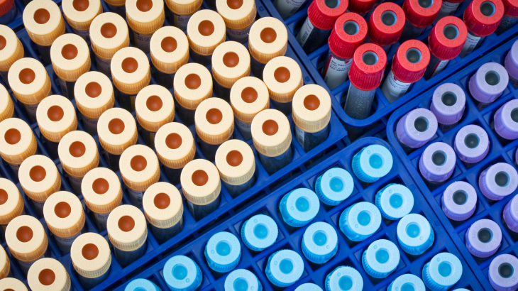 HLA B27 testi öncesinde özel bir hazırlık süreci bulunmaz, kişi açlık gereksinimi olmadan teste girebilir