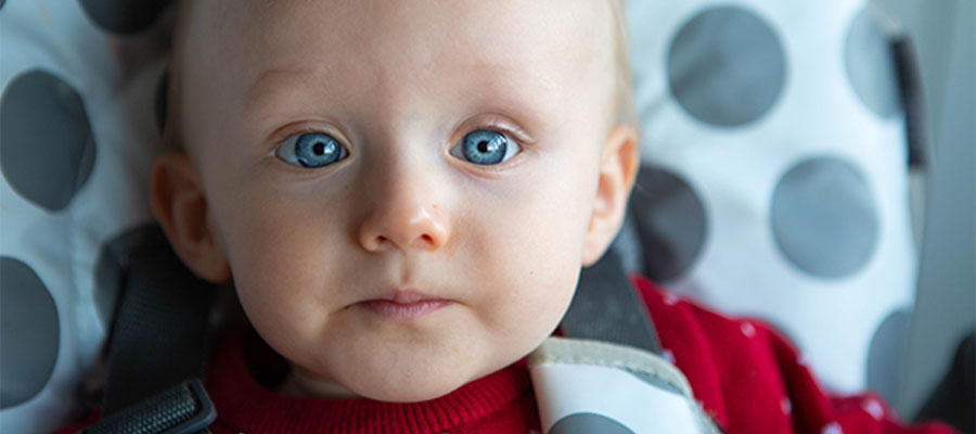 Göz sulanması yaşayan mavi gözlü bir bebek, epifora sorununun bebeklerde görülme durumuna örnek.