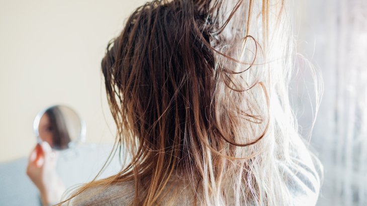 saç yağlanması neden olur