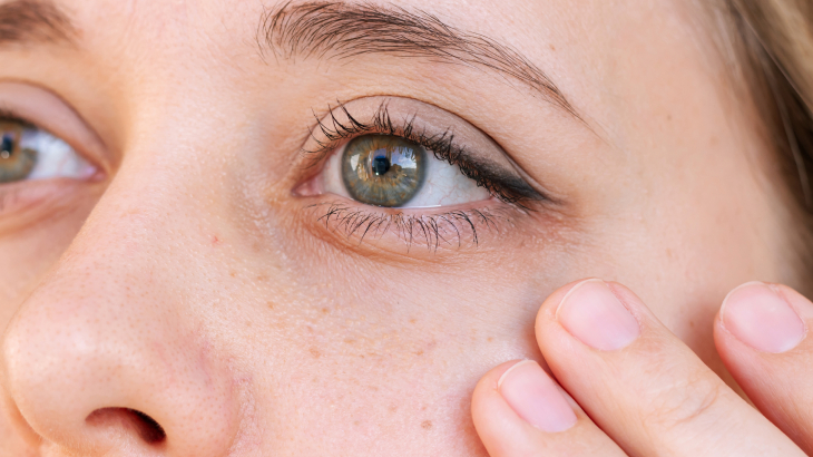 yetişkinlerde cilt problemleri