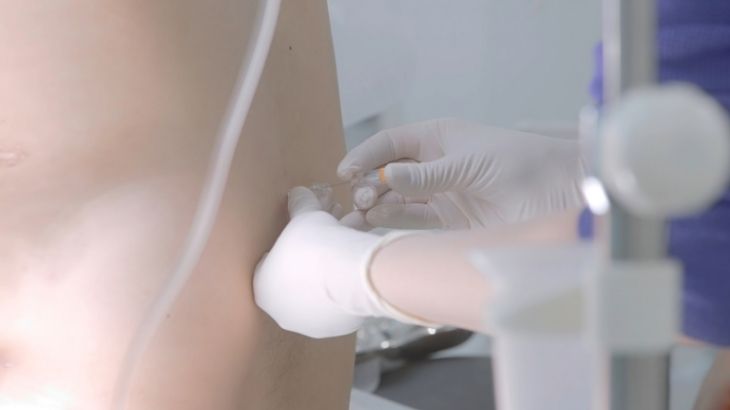 beyin-omurilik sıvı alma işlemi