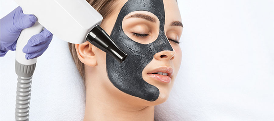 Yüzünde siyah karbon maske olan bir kadın, gözleri kapalı şekilde yatarken cilt uzmanı tarafından lazer peeling uygulaması yapılıyor.