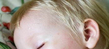 Çocuklarda sık görülen kalp hastalıkları