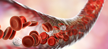 Şah Damarı Tıkanıklığı Belirtileri