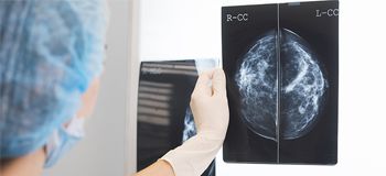 Meme kanseri tedavisinde nasıl beslenmeli?